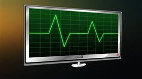 E.C.G Monitor