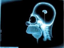 Simpson X-Ray
